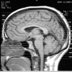 Brain image courtesy of Liz Henry