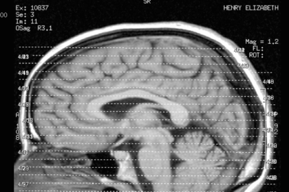 Brain image courtesy of Liz Henry