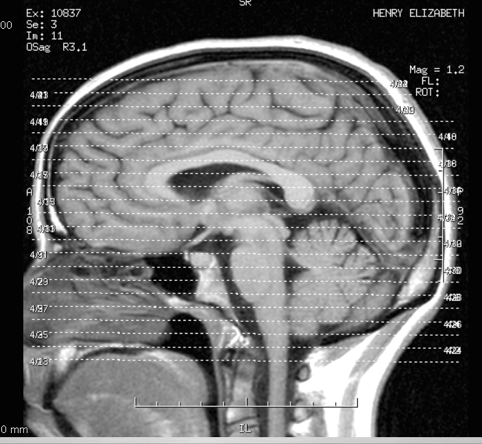 Brain image courtesy of Liz Henry