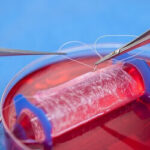 Tissue Engineering