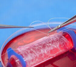 Tissue Engineering