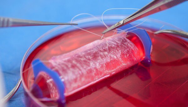 labvagina