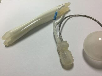A photo on inflatable penis prosthetic.