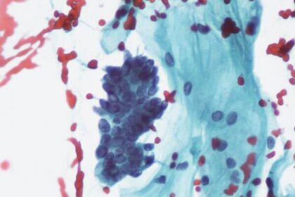A photo of a typical glandular cells