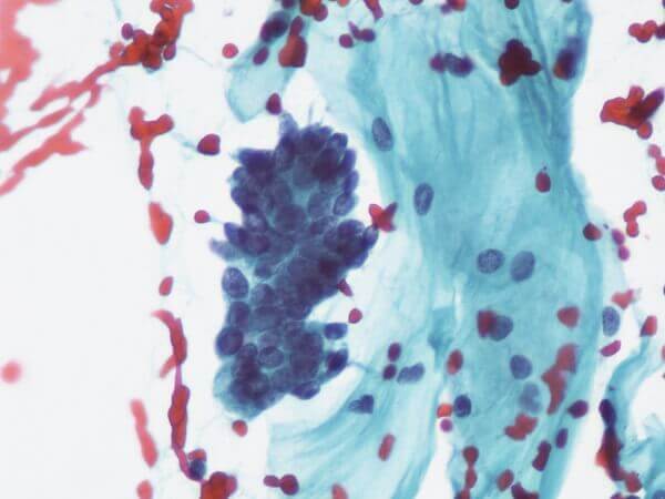 A photo of a typical glandular cells
