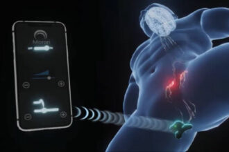 Screenshot from video clip demonstrating Morari wearable product for treating PE