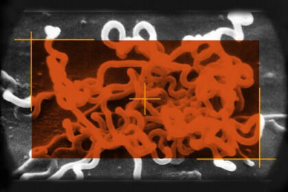 Image of Syphilis a Bacterium called Treponema Pallidum